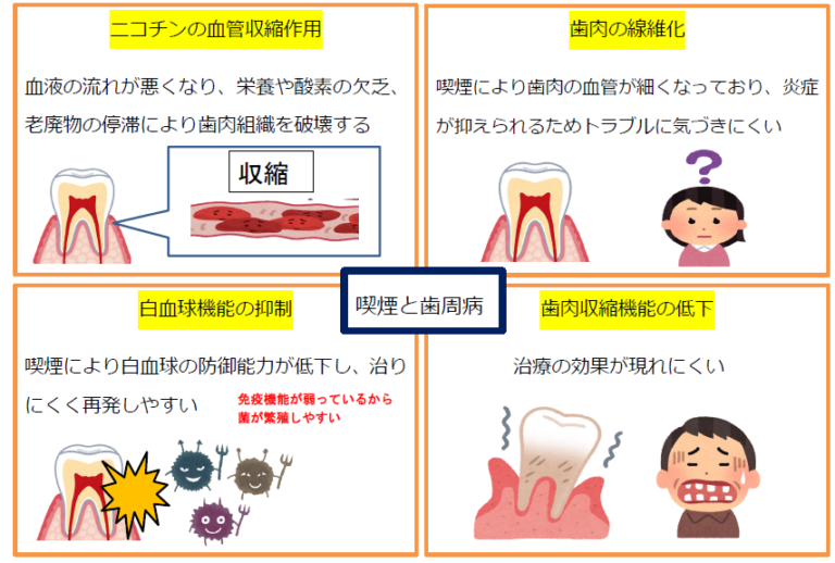 歯周病と喫煙 完成 お知らせ JFOHP日本口腔保健協会